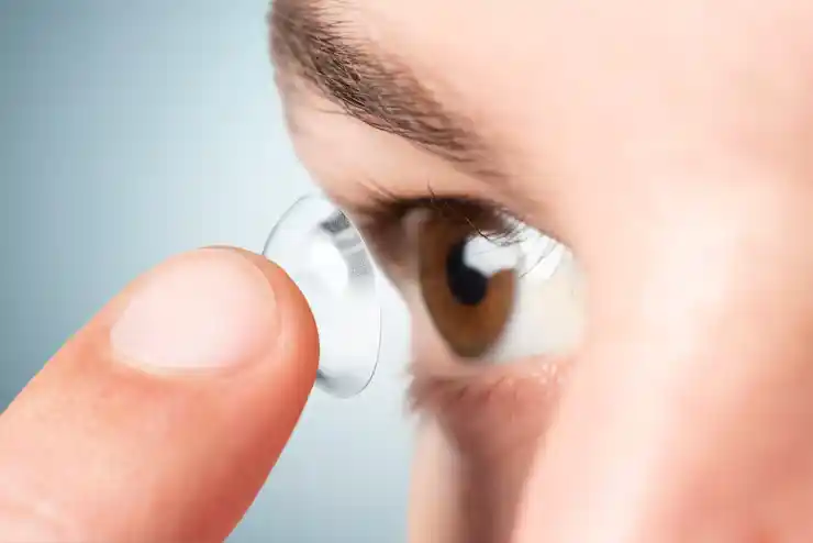 Implantable Collamer Lens (ICL) placement for correcting high myopia and thin corneas